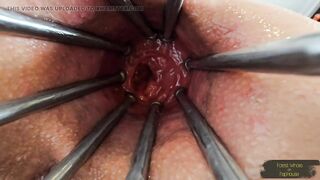 Extreme Anal Games with Enema and Prolapse