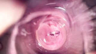 Internal camera inside vagina